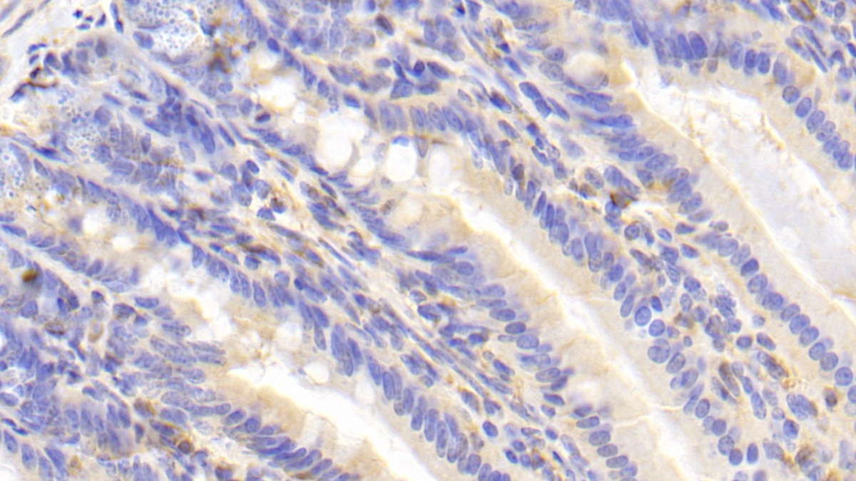 Polyclonal Antibody to Carcinoembryonic Antigen Related Cell Adhesion Molecule 1 (CEACAM1)