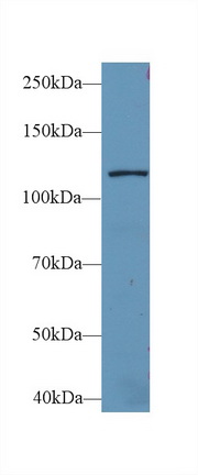 Polyclonal Antibody to Leucyl tRNA Synthetase (LARS)