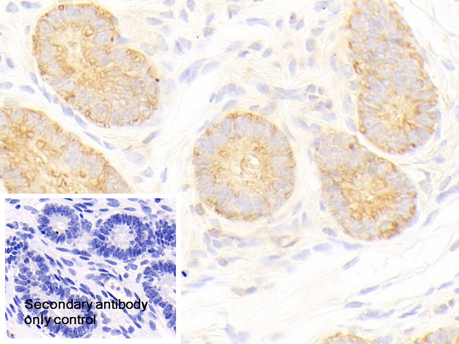 Polyclonal Antibody to Histidyl tRNA Synthetase (HARS)