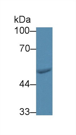 Polyclonal Antibody to Phenylalanyl tRNA Synthetase 2, Mitochondrial (FARS2)