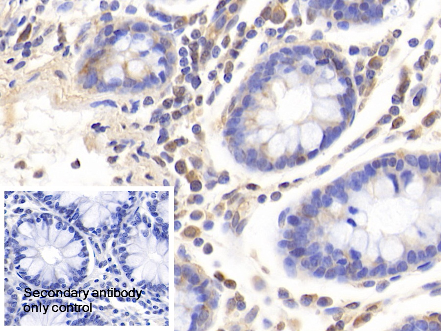 Polyclonal Antibody to Glutaminyl tRNA Synthetase (QARS)