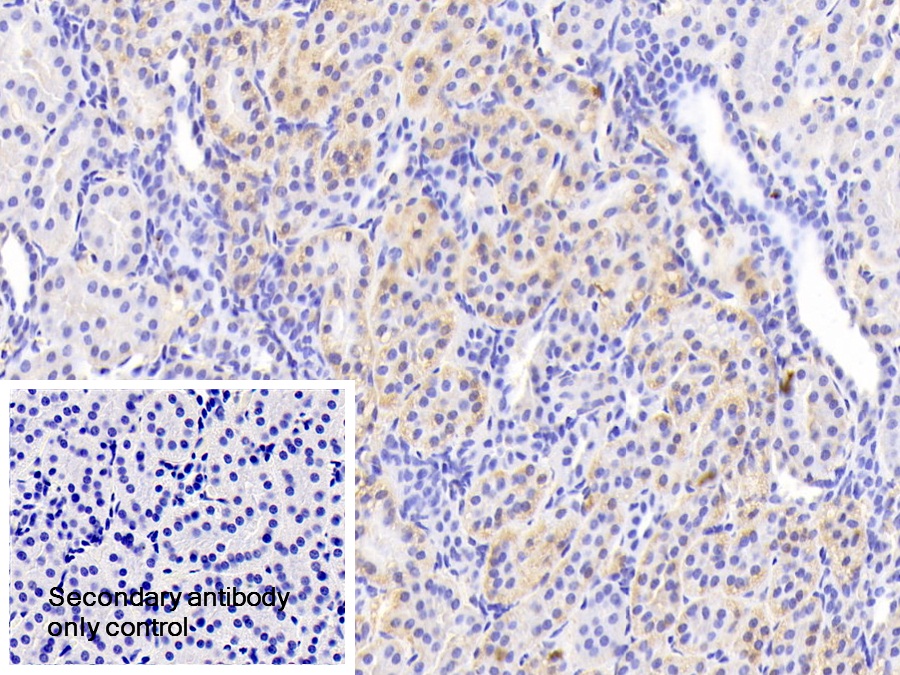 Polyclonal Antibody to Valyl tRNA Synthetase (VARS)