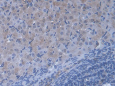 Polyclonal Antibody to Valyl tRNA Synthetase (VARS)