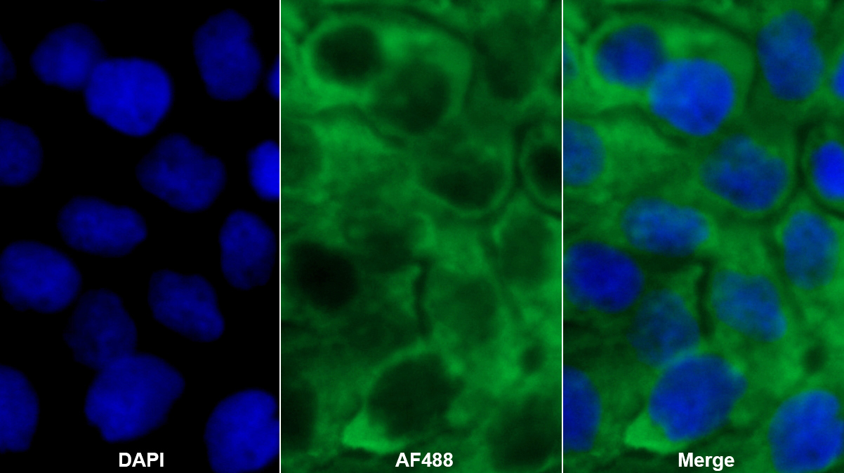 Polyclonal Antibody to Glutamyl Prolyl tRNA Synthetase (EPRS)