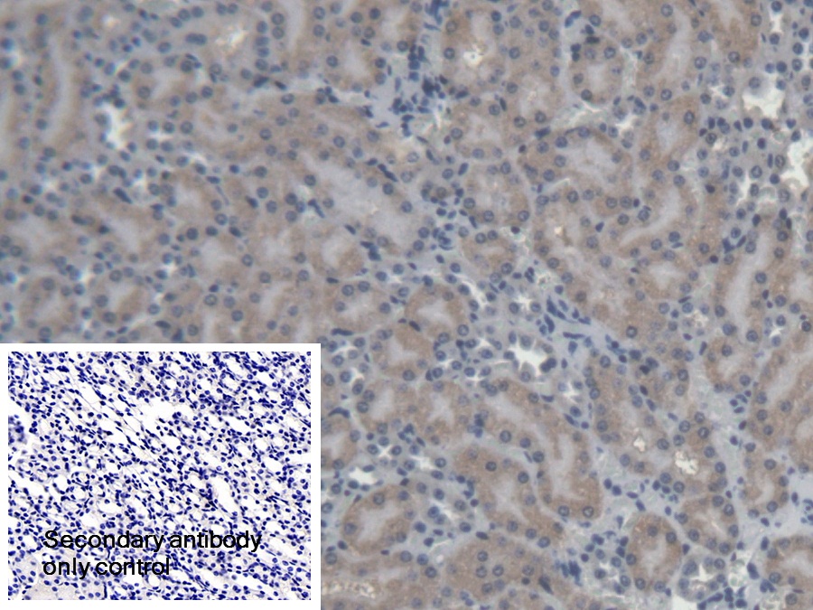 Polyclonal Antibody to Glutamyl Prolyl tRNA Synthetase (EPRS)