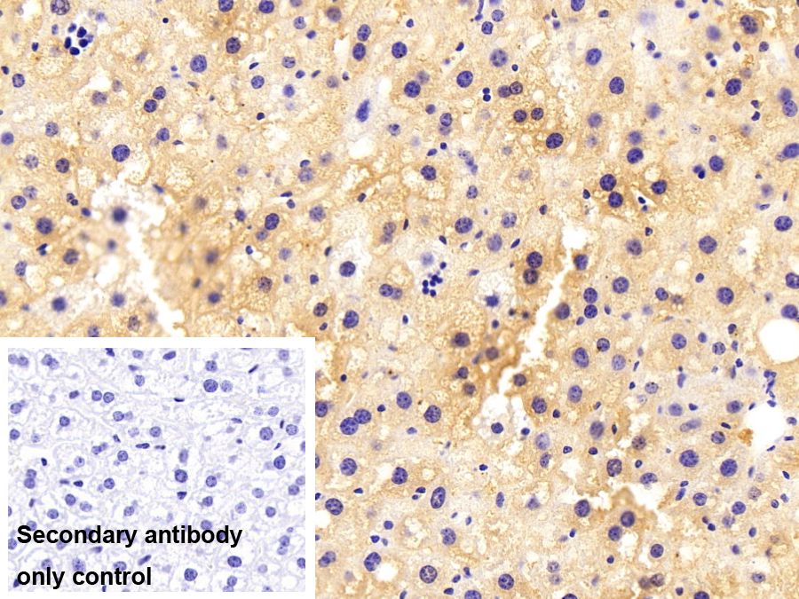 Polyclonal Antibody to Threonyl tRNA Synthetase (TARS)