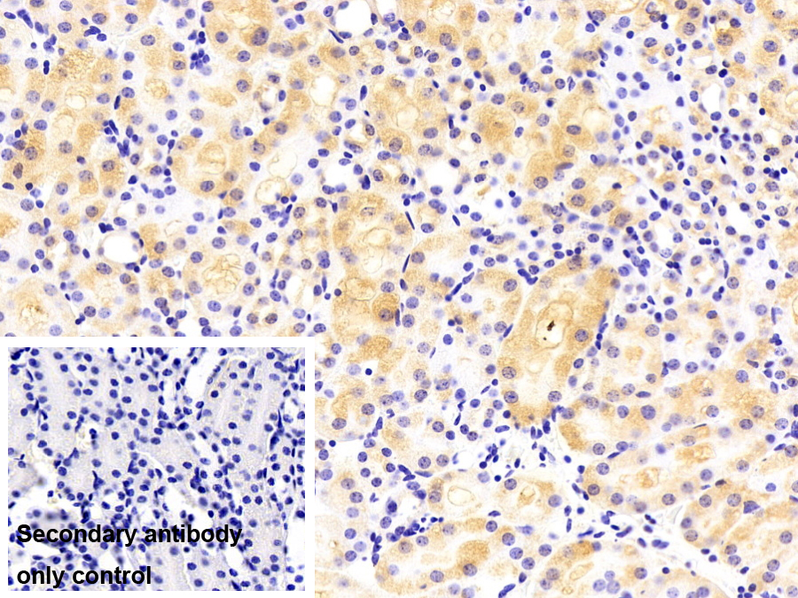 Polyclonal Antibody to Threonyl tRNA Synthetase (TARS)