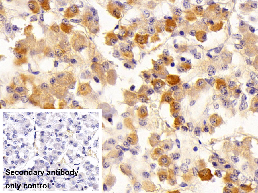 Polyclonal Antibody to Follicle Stimulating Hormone Beta (FSHb)