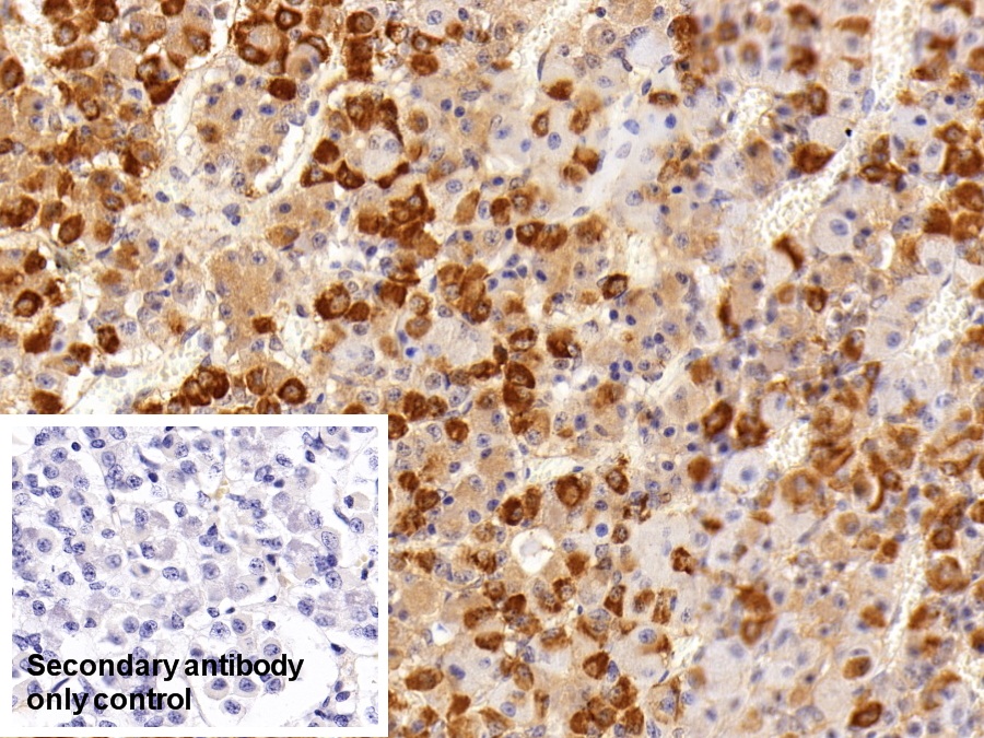 Polyclonal Antibody to Follicle Stimulating Hormone Beta (FSHb)