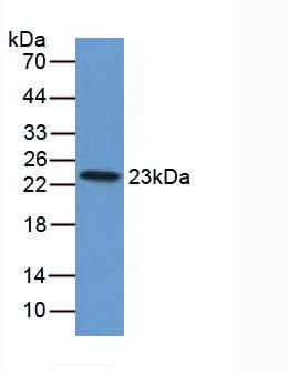 Polyclonal Antibody to Ferritin, Light Polypeptide (FTL)