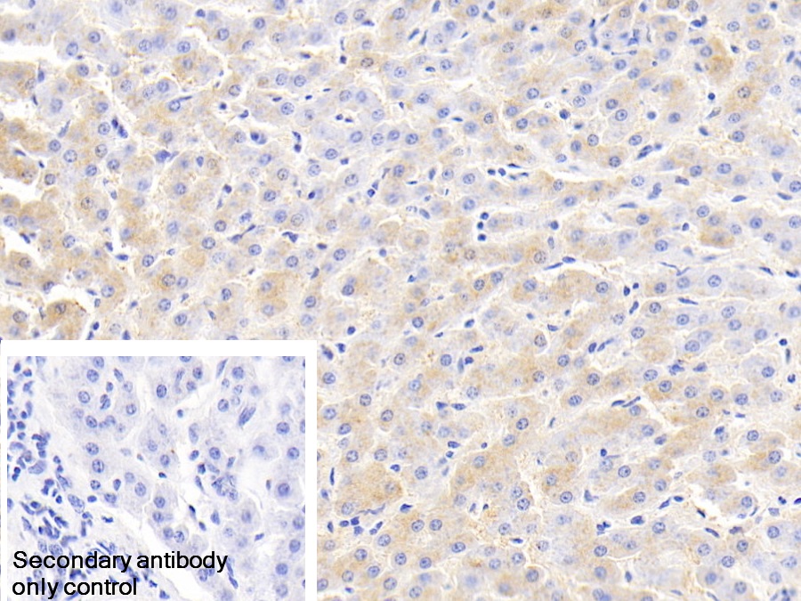 Polyclonal Antibody to Ferritin, Light Polypeptide (FTL)