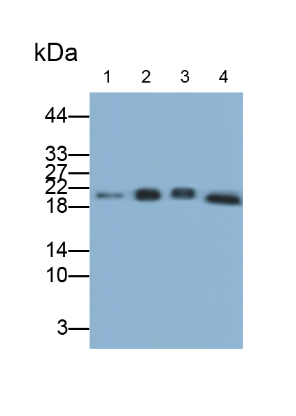 Polyclonal Antibody to Ferritin, Light Polypeptide (FTL)
