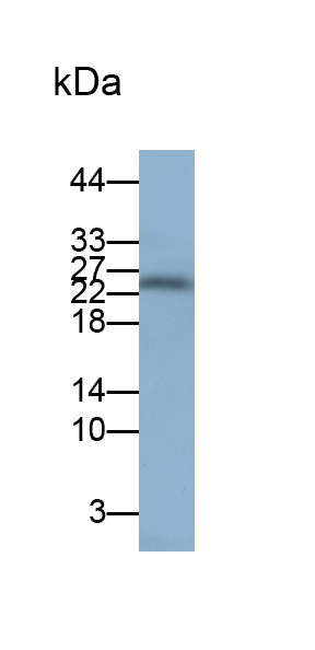 Polyclonal Antibody to Ferritin, Light Polypeptide (FTL)