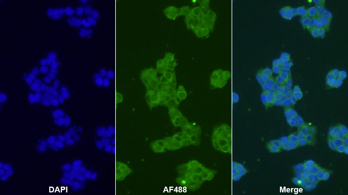 Polyclonal Antibody to Ferritin, Light Polypeptide (FTL)