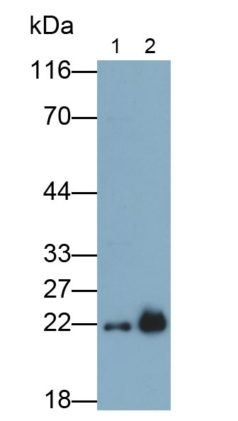 Polyclonal Antibody to Ferritin, Light Polypeptide (FTL)