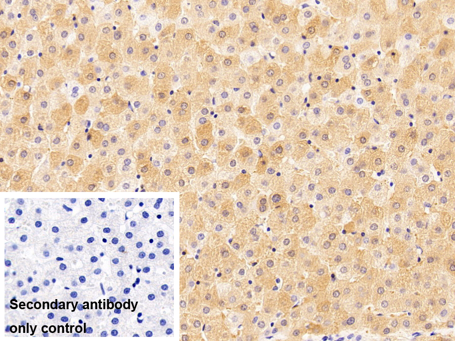 Polyclonal Antibody to Ferritin, Light Polypeptide (FTL)