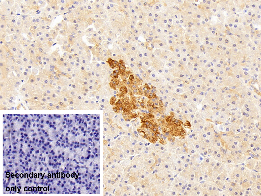 Polyclonal Antibody to Ferritin, Light Polypeptide (FTL)