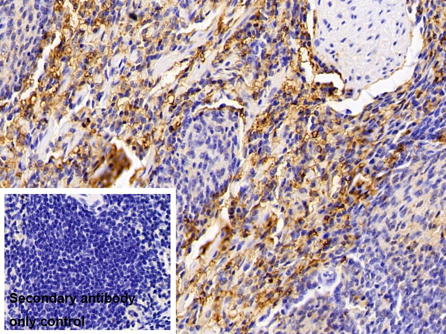 Polyclonal Antibody to Ferritin, Light Polypeptide (FTL)
