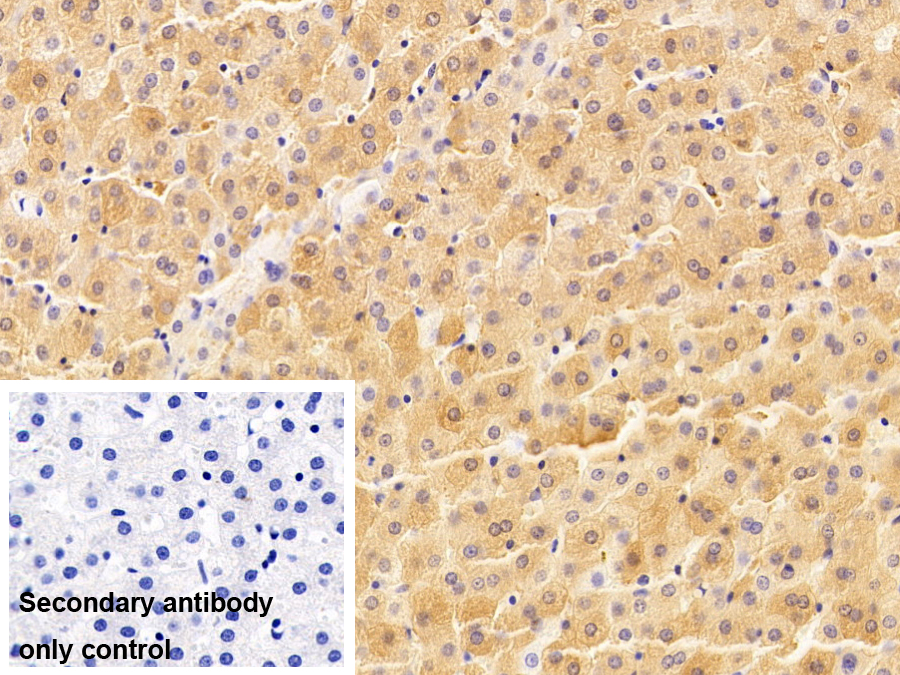 Polyclonal Antibody to Ferritin, Light Polypeptide (FTL)