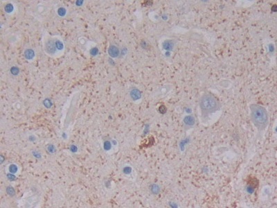 Polyclonal Antibody to Ferritin, Light Polypeptide (FTL)