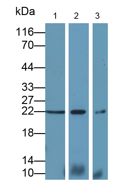 Polyclonal Antibody to Ferritin, Light Polypeptide (FTL)