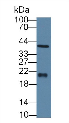 Polyclonal Antibody to Ferritin, Heavy Polypeptide (FTH)