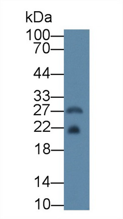 Polyclonal Antibody to Ferritin, Heavy Polypeptide (FTH)