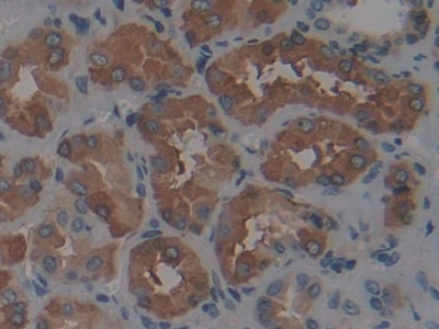 Polyclonal Antibody to Ferritin, Heavy Polypeptide (FTH)