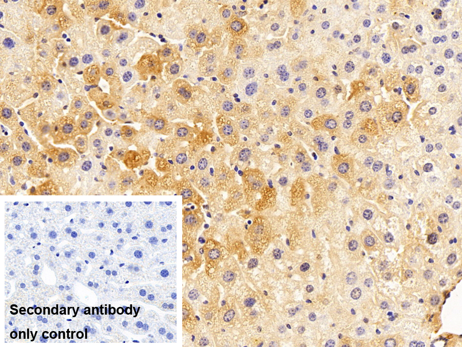 Polyclonal Antibody to Ferritin, Heavy Polypeptide (FTH)