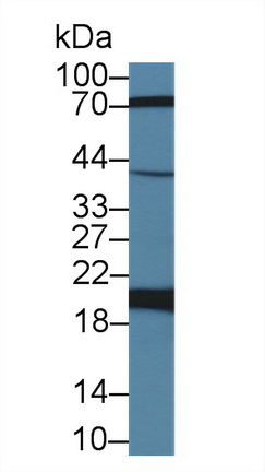 Polyclonal Antibody to Ferritin, Heavy Polypeptide (FTH)