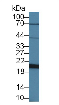 Polyclonal Antibody to Ferritin, Heavy Polypeptide (FTH)