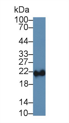 Polyclonal Antibody to Ferritin, Heavy Polypeptide (FTH)