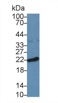 Polyclonal Antibody to Ferritin, Heavy Polypeptide (FTH)