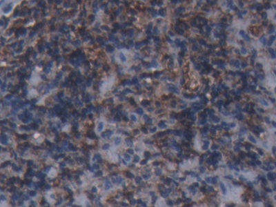 Polyclonal Antibody to Ferritin, Heavy Polypeptide (FTH)