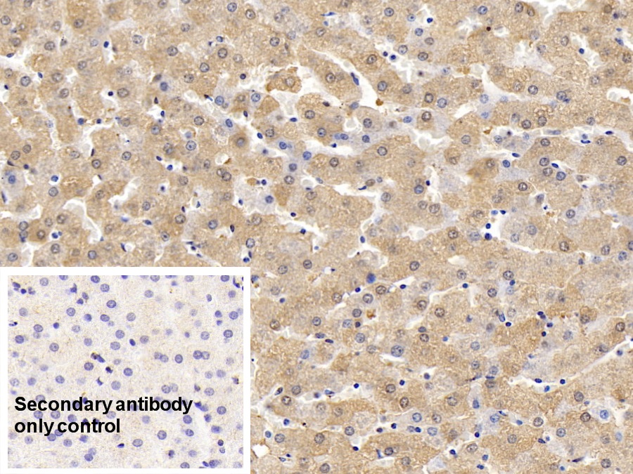 Polyclonal Antibody to Ferritin, Heavy Polypeptide (FTH)