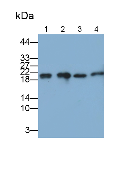 Polyclonal Antibody to Ferritin, Heavy Polypeptide (FTH)