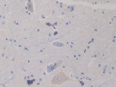 Polyclonal Antibody to Heat Shock 70kDa Protein 8 (HSPA8)