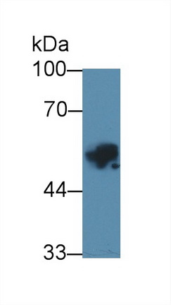 Polyclonal Antibody to Carbonic Anhydrase IX (CA9)