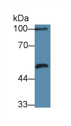 Polyclonal Antibody to Carbonic Anhydrase IX (CA9)