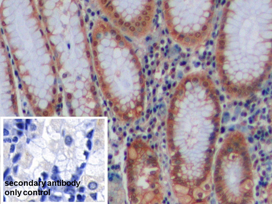 Polyclonal Antibody to Carbonic Anhydrase IX (CA9)