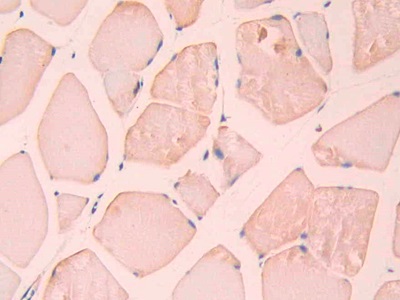 Polyclonal Antibody to Carbonic Anhydrase XII (CA12)