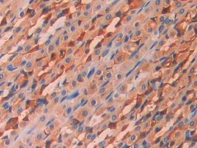 Polyclonal Antibody to Carbonic Anhydrase XII (CA12)