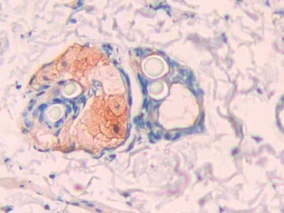 Polyclonal Antibody to Carbonic Anhydrase XII (CA12)