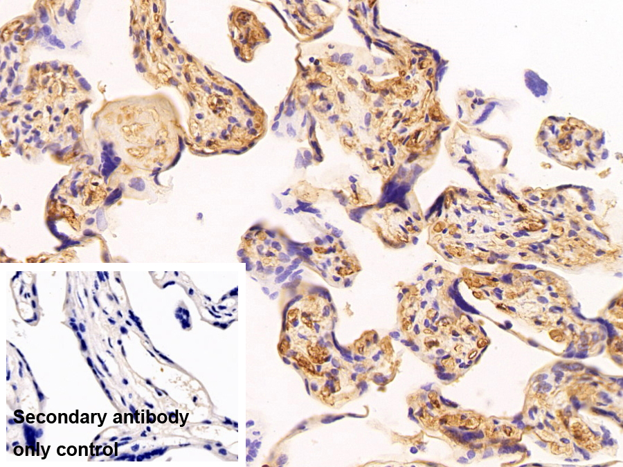 Polyclonal Antibody to Hemoglobin Epsilon 1 (HBe1)