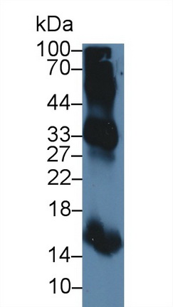 Polyclonal Antibody to Hemoglobin Beta (HBb)