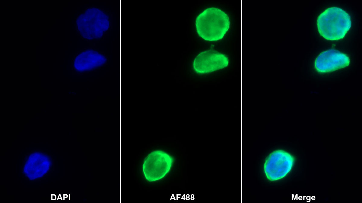 Polyclonal Antibody to Hemoglobin Beta (HBb)