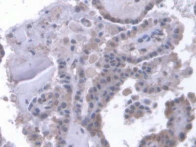Polyclonal Antibody to Low Density Lipoprotein Receptor Related Protein 1B (LRP1B)
