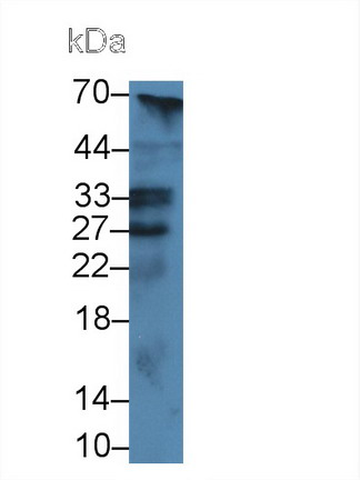 Polyclonal Antibody to Low Density Lipoprotein Receptor Adaptor Protein 1 (LDLRAP1)