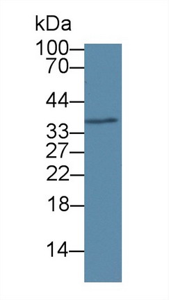 Polyclonal Antibody to Ribonuclease H2 Subunit A (RNASEH2A)