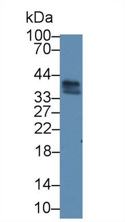 Polyclonal Antibody to Ribonuclease H2 Subunit A (RNASEH2A)